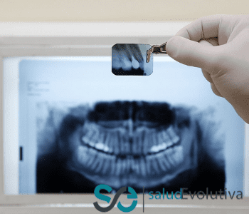 ¿QUÉ ES UNA ORTOPANTOMOGRAFÍA Y PARA QUÉ SIRVE? 1